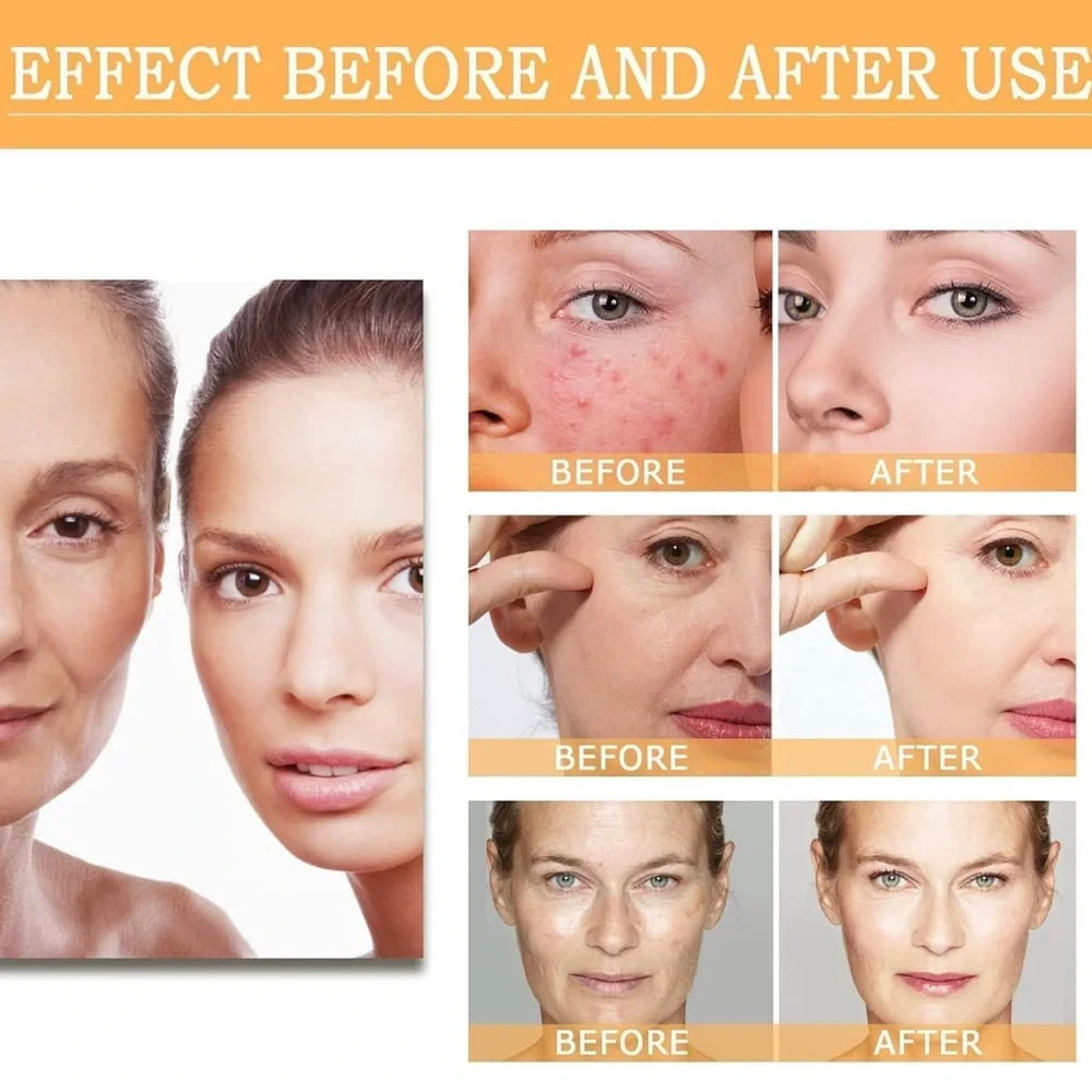 Glycolic Acid 7% Toning Solution 8 oz Direct Acids Radiant Skin‎ Anti Aging/Acne